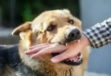 Shocking Case:डॉग लवर को 2 साल पहले काटा था कुत्ते ने, रेबीज से हुई दर्दनाक मौत