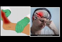 Numbness in the Foot : पैर का सुन्न हो जाना, हम सब के लिए सामान्य बात है, लेकिन ब्रेन में क्लॉटिंग—–जाड़ों में पानी पीने की आदत बनाए रखें!