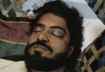 Mumbai Drug Case : अंतरराज्यीय ड्रग माफिया, हिस्ट्रीशीटर भय्यू लाला की संदिग्ध परिस्थितियों में मौत?