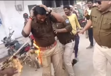 Congress Protest in Maihar: कांग्रेस के प्रदर्शन को रोकने बुरी तरह आग से झुलसे TI विक्रम पाठक