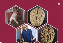 ‘पा और पा : पार्किन्सोनिज्म और मेरे पापा’ -पार्किन्सन रोग पर डॉ. अपूर्व पौराणिक की हिन्दी किताब 'पा और पा : पार्किन्सोनिज्म और मेरे पापा