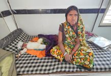 झोपड़ी में लगी आग से 6 माह की मासूम गंभीर रूप से झुलसी, मां जलती झोपड़ी में कूदकर बेटी को बचा लाई