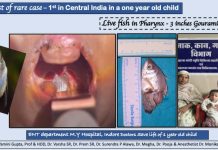 Indore MYH के डॉक्टरों ने किया कमाल: एक साल के मासूम के गले में फंसी थी ‘जिंदा मछली’- जटिल ऑपरेशन के बाद बच्चे को मिली नयी जिन्दगी