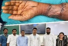 Big Medical Achievement: 70 वर्षीय बुजुर्ग के कटे हाथ को दोबारा जोड़ा, Aims डॉक्टरों को मिली सफलता