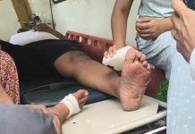 खाना बनाने के बाद सफाई को लेकर विवाद, तीर्थ यात्रियों और फैक्ट्री कर्मचारियों में मारपीट; 12 घायल, 28 के खिलाफ प्रकरण दर्ज
